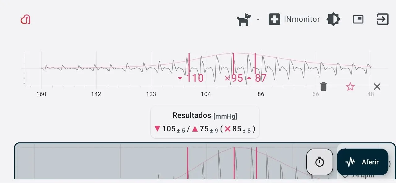 Curva oscilométrica de alta definição (HD) da pressão arterial